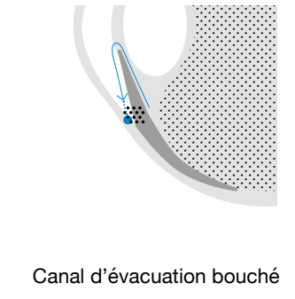 Schéma vision / oeil myope